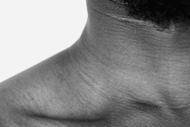 tratamento-para-cervical-pescoco